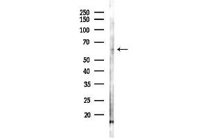 Western blot analysis of lysates from Rat lung, using SLC15 Antibody at 1/1000 dilution.