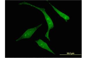 Immunofluorescence of monoclonal antibody to RGS14 on HeLa cell. (RGS14 抗体  (AA 1-566))