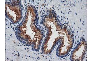 Immunohistochemical staining of paraffin-embedded Human prostate tissue using anti-JOSD1 mouse monoclonal antibody. (JOSD1 抗体)
