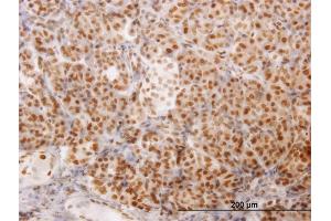 Immunoperoxidase of monoclonal antibody to NCOA4 on formalin-fixed paraffin-embedded human pancreas. (NCOA4 抗体  (AA 505-614))
