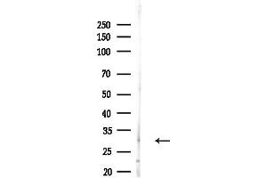 anti-Aspartoacylase (ASPA) (Internal Region) antibody