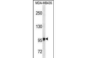 EXTL3 Antibody (N-term) (ABIN656662 and ABIN2845903) western blot analysis in MDA-M cell line lysates (35 μg/lane). (EXTL3 抗体  (N-Term))