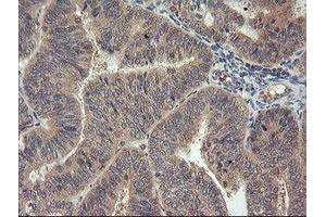 Image no. 1 for anti-Mitogen-Activated Protein Kinase Kinase 3 (MAP2K3) antibody (ABIN1499401) (MAP2K3 抗体)
