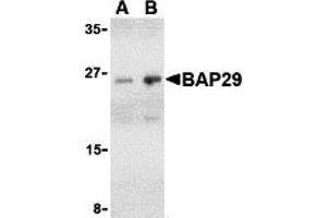 Western Blotting (WB) image for anti-B-Cell Receptor-Associated Protein 29 (BCAP29) (Middle Region) antibody (ABIN1030881) (BCAP29 抗体  (Middle Region))