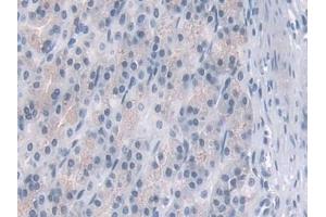 Detection of PDE4B in Rat Stomach Tissue using Polyclonal Antibody to Phosphodiesterase 4B, cAMP Specific (PDE4B) (PDE4B 抗体  (AA 500-736))