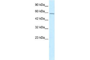 WB Suggested Anti-MGC4618 Antibody Titration:  0. (TMEM175 抗体  (N-Term))