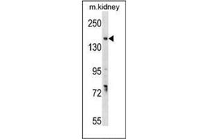 Western blot analysis of GREB1 Antibody  in mouse kidney tissue lysates (35ug/lane). (GREB1 抗体  (Middle Region))