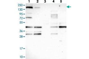 Western blot analysis of Lane 1: RT-4, Lane 2: U-251 MG, Lane 3: Human Plasma, Lane 4: Liver, Lane 5: Tonsil with SH3TC1 polyclonal antibody . (SH3TC1 抗体)
