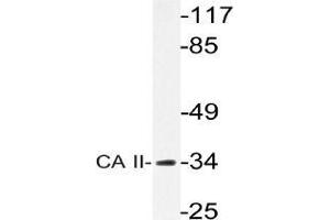Western blot analysis of Carbonic anhydrase 2 antibody in extracts from rat heart cells. (CA2 抗体)
