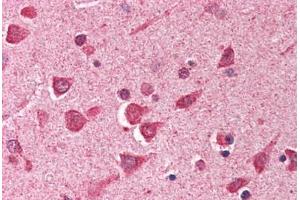 Human Brain, Cortex (formalin-fixed, paraffin-embedded) stained with ING1 antibody ABIN290441 at 2. (ING1 抗体  (AA 285-296))