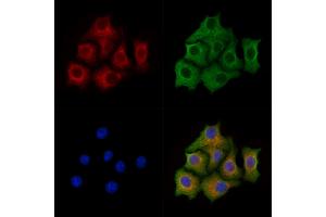 ABIN7094441 and ABIN7098489 staining Hela cells by IF/ICC.