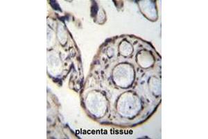 CAPN6 Antibody (Center) immunohistochemistry analysis in formalin fixed and paraffin embedded human placenta tissue followed by peroxidase conjugation of the secondary antibody and DAB staining. (Calpain 6 抗体  (Middle Region))