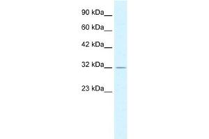 Western Blotting (WB) image for anti-Proteasome (Prosome, Macropain) 26S Subunit, Non-ATPase, 14 (PSMD14) (C-Term) antibody (ABIN2779652)
