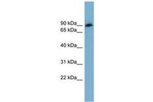 Image no. 1 for anti-Amyloid beta (A4) Precursor Protein-Binding, Family B, Member 1 Interacting Protein (APBB1IP) (AA 71-120) antibody (ABIN6744167) (Amyloid beta (A4) Precursor Protein-Binding, Family B, Member 1 Interacting Protein (APBB1IP) (AA 71-120) 抗体)