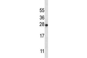 IL-22 antibody western blot analysis in K562 lysate (IL-22 抗体  (AA 44-73))