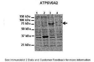 ATP6V0A2 抗体  (N-Term)