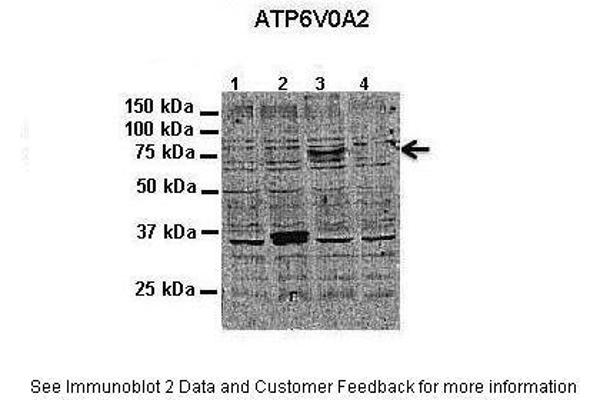 ATP6V0A2 抗体  (N-Term)