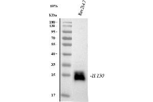 Western blot analysis of GILT/IFI30 using anti-GILT/IFI30 antibody (ABIN7602781).