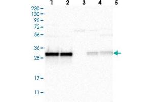 Western blot analysis of Lane 1: RT-4, Lane 2: U-251 MG, Lane 3: Human Plasma, Lane 4: Liver, Lane 5: Tonsil with MRPL45 polyclonal antibody  at 1:250-1:500 dilution. (MRPL45 抗体)