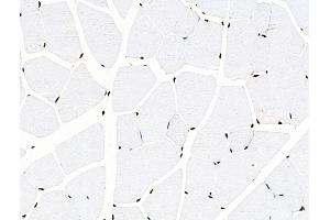 ABIN6256599 and ABIN6267082 at 1/100 staining Mouse muscle tissue by IHC-P.