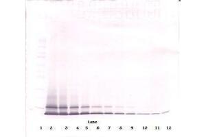 Image no. 1 for anti-Chemokine (C-X-C Motif) Ligand 1 (Melanoma Growth Stimulating Activity, Alpha) (CXCL1) antibody (ABIN465459)