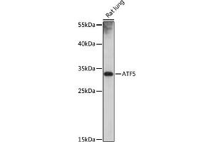 Western blot analysis of extracts of rat lung, using  antibody (ABIN7265407) at 1:1000 dilution. (ATF5 抗体)