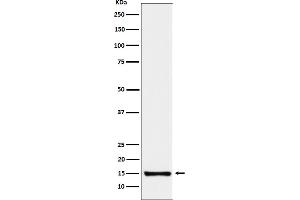 Western blot analysis of SAA4 expression in Human plasma cell lysate.