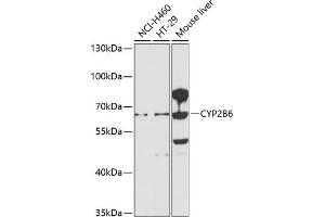 Western blot analysis of extracts of various cell lines, using CYP2B6 antibody (ABIN1679474, ABIN5663912, ABIN5663914 and ABIN6218554) at 1:1000 dilution. (CYP2B6 抗体  (AA 160-340))