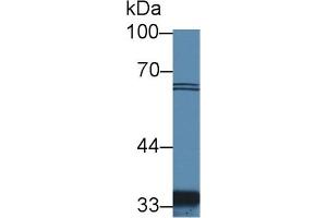 Detection of SLC30A8 in Human Hela cell lysate using Polyclonal Antibody to Solute Carrier Family 30 Member 8 (SLC30A8) (SLC30A8 抗体  (AA 263-369))