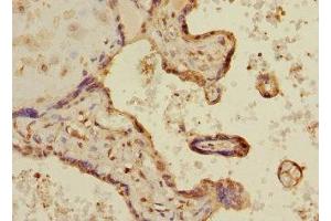 Immunohistochemistry of paraffin-embedded human placenta tissue using ABIN7158991 at dilution of 1:100 (MAPKAP Kinase 3 抗体  (AA 1-240))