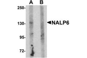 Western blot analysis of NALP5 in mouse brain tissue lysate with NALP5 antibody at 1 μg/ml in (A) the absence and (B) the presence of blocking peptide. (NLRP6 抗体  (N-Term))