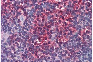 Human Thymus: Formalin-Fixed, Paraffin-Embedded (FFPE) (Arrestin 3 抗体  (AA 300-410))