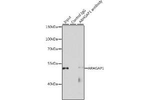 Immunoprecipitation analysis of 200 μg extracts of HeLa cells, using 3 μg  antibody (ABIN1678739, ABIN3018026, ABIN3018027 and ABIN6220339). (ARHGAP1 抗体  (AA 210-439))