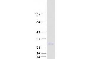 Western Blotting (WB) image for Nurim (Nuclear Envelope Membrane Protein) (NRM) protein (Myc-DYKDDDDK Tag) (ABIN2727830)