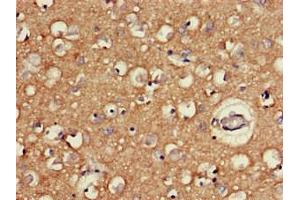 Immunohistochemistry of paraffin-embedded human brain tissue using ABIN7166533 at dilution of 1:100 (FAT3 抗体  (AA 1209-1470))
