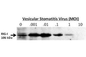 Western Blotting (WB) image for anti-DEAD (Asp-Glu-Ala-Asp) Box Polypeptide 58 (DDX58) (AA 894-925) antibody (ABIN3030701)