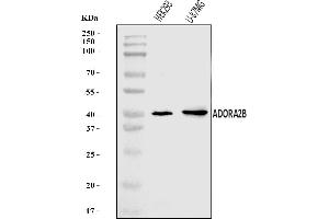 Western blot analysis of ADORA2B using anti-ADORA2B antibody (ABIN7600066).