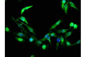 Immunofluorescence staining of Hela cells with ABIN7154415 at 1:266, counter-stained with DAPI. (GZMB 抗体  (AA 21-247))