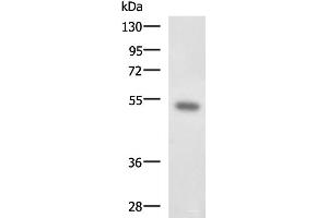 Western blot analysis of Mouse kidney tissue lysate using FOXQ1 Polyclonal Antibody at dilution of 1:650 (FOXQ1 抗体)