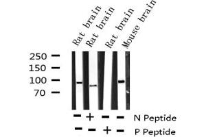 Western blot analysis of Phospho-Dynamin-1 (Ser774) expression in various lysates (Dynamin 1 抗体  (pSer774))