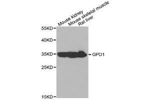 Western blot analysis of extracts of various cell lines, using GPD1 antibody. (GPD1 抗体)