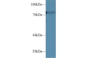 Detection of CD2AP in Rat Liver lysate using Polyclonal Antibody to CD2 Associated Protein (CD2AP)