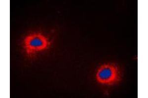 Immunofluorescent analysis of NIP1 staining in COLO205 cells. (BNIP1 抗体  (C-Term))