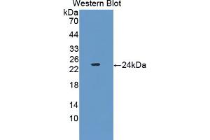 Western blot analysis of the recombinant protein. (PEBP1 抗体  (AA 2-187))