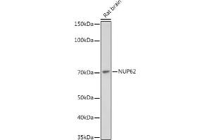 Western blot analysis of extracts of Rat brain, using NUP62 antibody (ABIN7269045) at 1:1000 dilution. (NUP62 抗体)