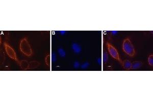 Immunocytochemistry (ICC) image for anti-Stromal Interaction Molecule 1 (STIM1) (AA 56-69), (Extracellular) antibody (ABIN7043781)