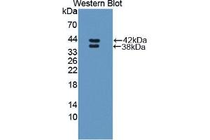 Western blot analysis of the recombinant protein. (RETNLB 抗体  (AA 24-111))