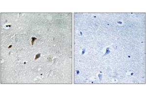 Immunohistochemistry analysis of paraffin-embedded human brain, using MAP2K3 (Phospho-Thr222) Antibody. (MAP2K3 抗体  (pThr222))