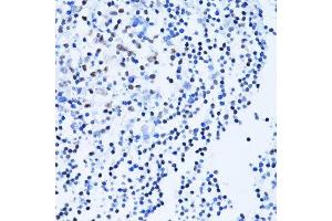 Immunohistochemistry of paraffin-embedded human tonsil using PARP1 antibody. (PARP1 抗体  (AA 81-390))