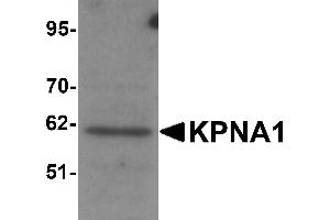 Western Blotting (WB) image for anti-Karyopherin alpha 1 (Importin alpha 5) (KPNA1) (N-Term) antibody (ABIN1031429) (KPNA1 抗体  (N-Term))